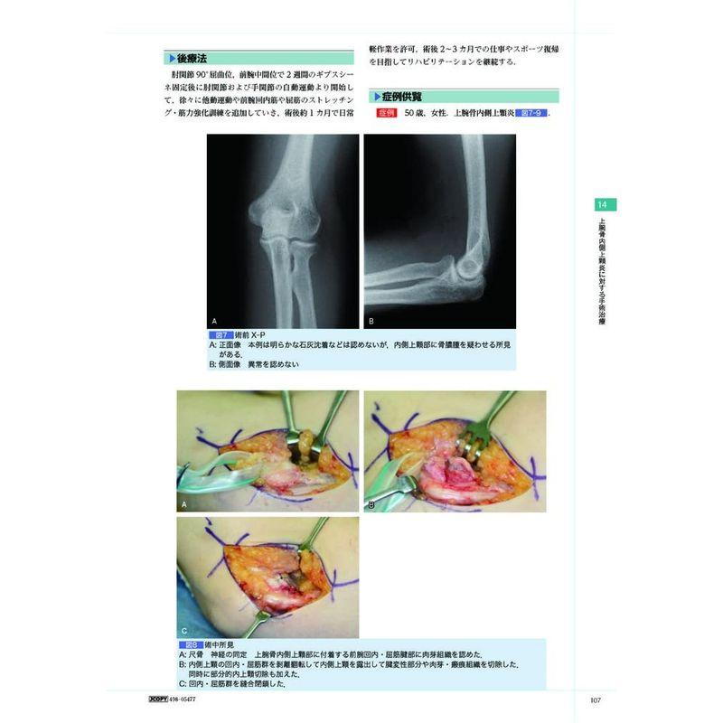 手の外科 私のアプローチ (新品) - 健康/医学