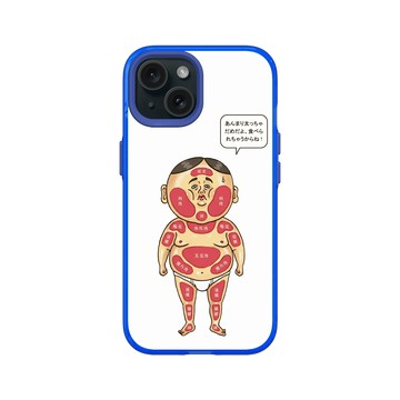 iPhone 15 Clear 激光藍 - 保羅先生 Mr.Paul - 圖解人體部位