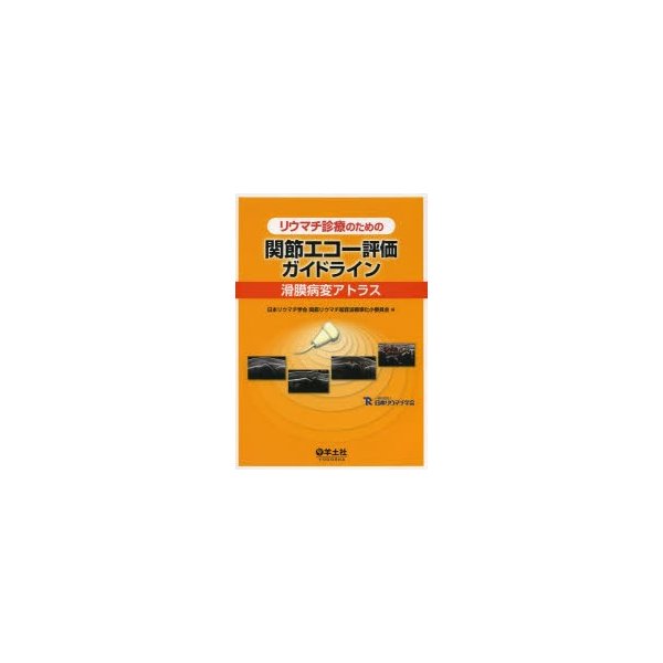 リウマチ診療のための 関節エコー評価ガイドライン~滑膜病変アトラス