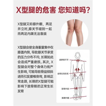 (免運)X型腿矯正鞋墊成人內八字改善腿型足弓支撐X腿直腿矯正墊走路姿勢