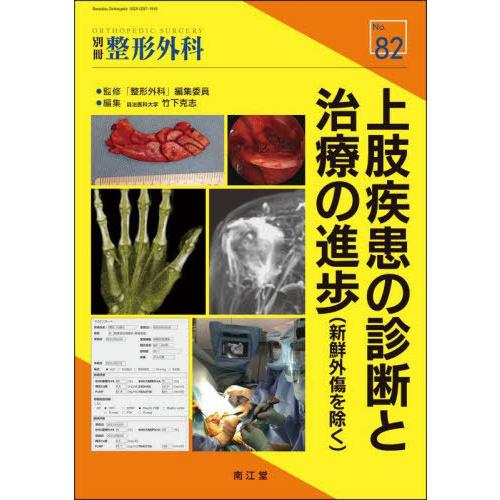 上肢疾患の診断と治療の進歩