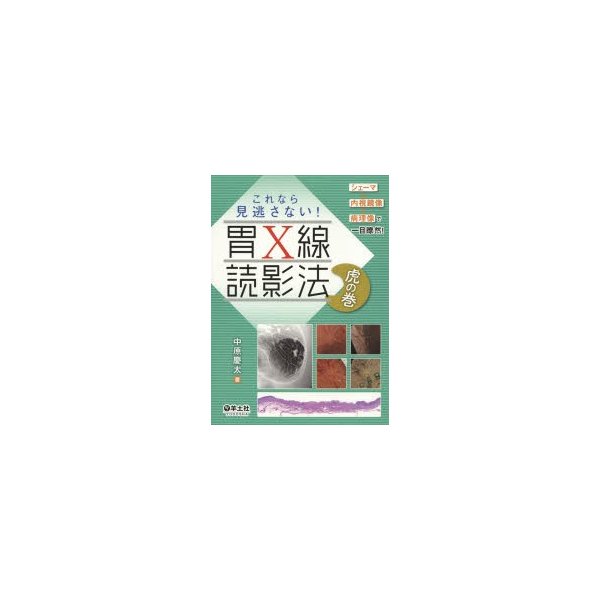 これなら見逃さない 胃X線読影法虎の巻 シェーマ 内視鏡像 病理像で一目瞭然