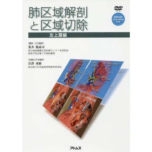 肺区域解剖と区域切除 左上葉編