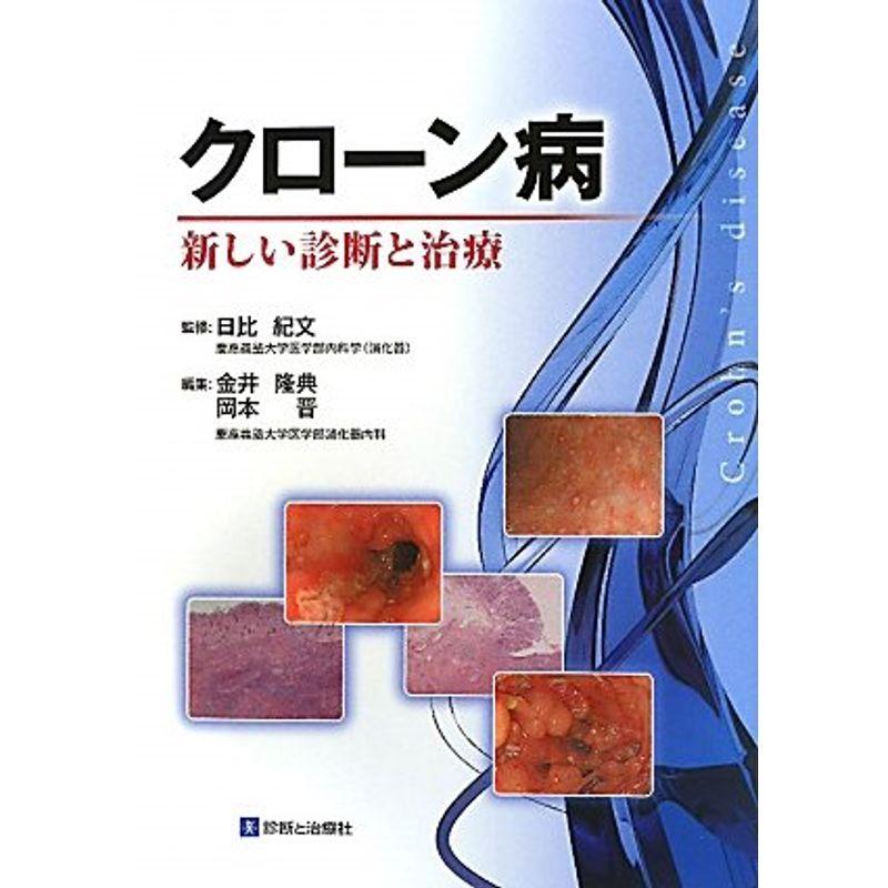 クローン病?新しい診断と治療