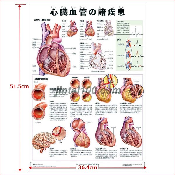 心臓血管の諸疾患 J9915p 人体図 医学ポスター 世界一流のメディカルイラスト 通販 Lineポイント最大0 5 Get Lineショッピング