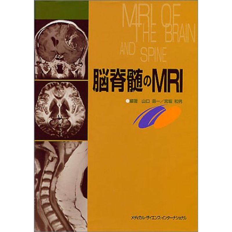 脳脊髄のMRI