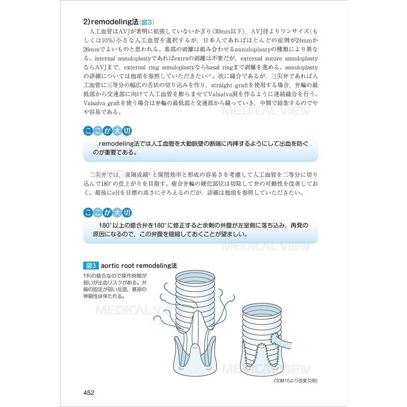 ハートチームのための 心臓血管外科手術 周術期管理のすべて