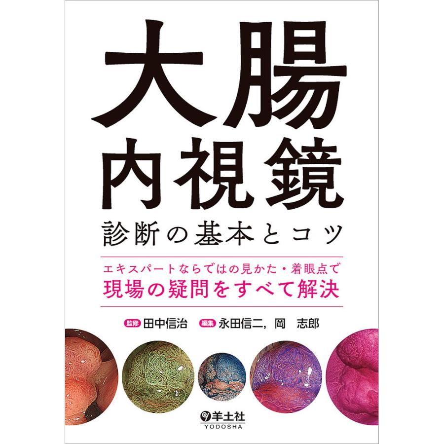 大腸内視鏡診断の基本とコツ エキスパートならではの見かた・着眼点で現場の疑問をすべて解決