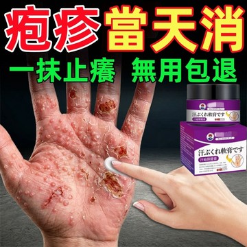 日本爆款 汗皰 胗 水泡 濕 胗膏 皮膚瘙癢 脫皮 皮膚 紅腫不適 瘙癢難忍 日常肌膚護理 乳膏 皮膚癢膏肌膚保