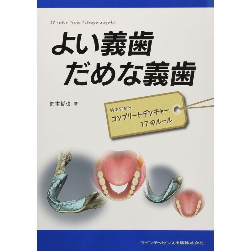 よい義歯 だめな義歯