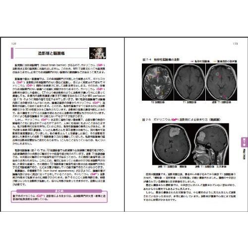 心から納得・理解できるMRI原理とMRS