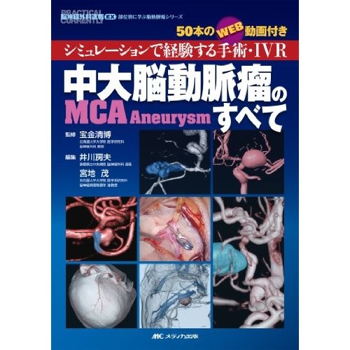 中大脳動脈瘤(MCA Aneurysm)のすべて: シミュレーションで経験する手術・IV