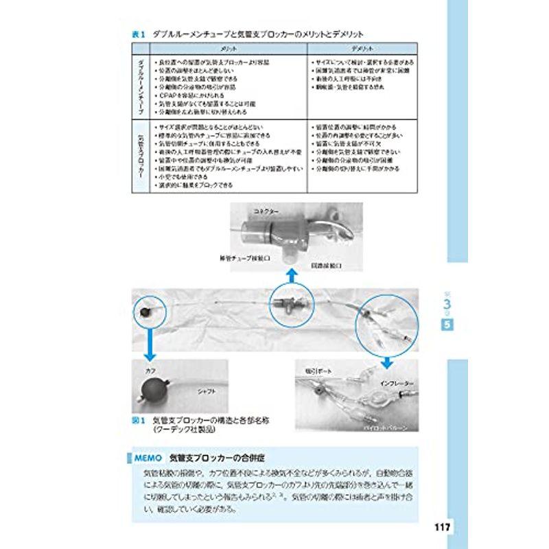 胸部手術の麻酔 一側肺換気の手技と知識を知る電子版付