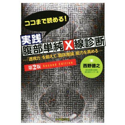 ココまで読める！実践腹部単純Ｘ線診断 透視力を鍛えて臨床推論能力を高める／西野徳之(著者)