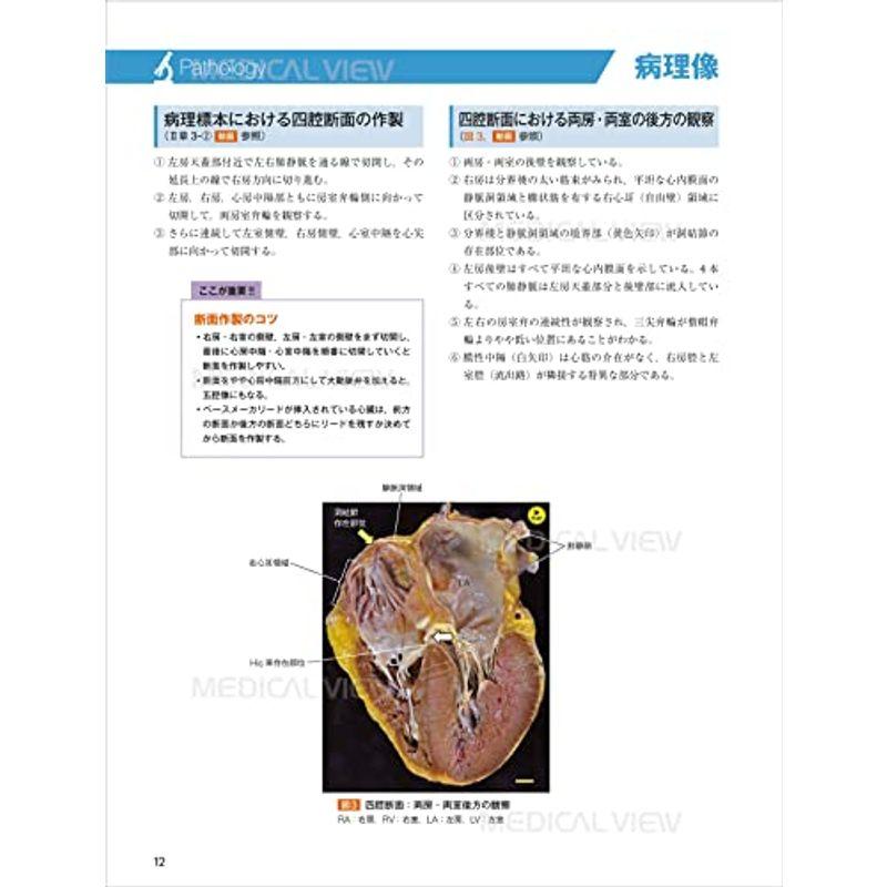 心エコー図検査に役立つ ヒト心臓形態のすべて