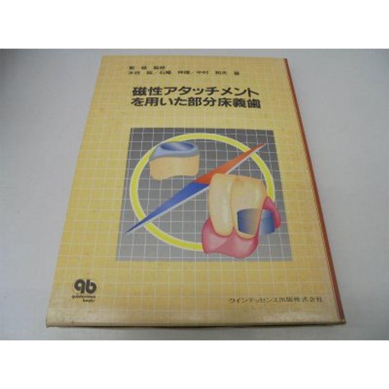 磁性アタッチメントを用いた部分床義歯