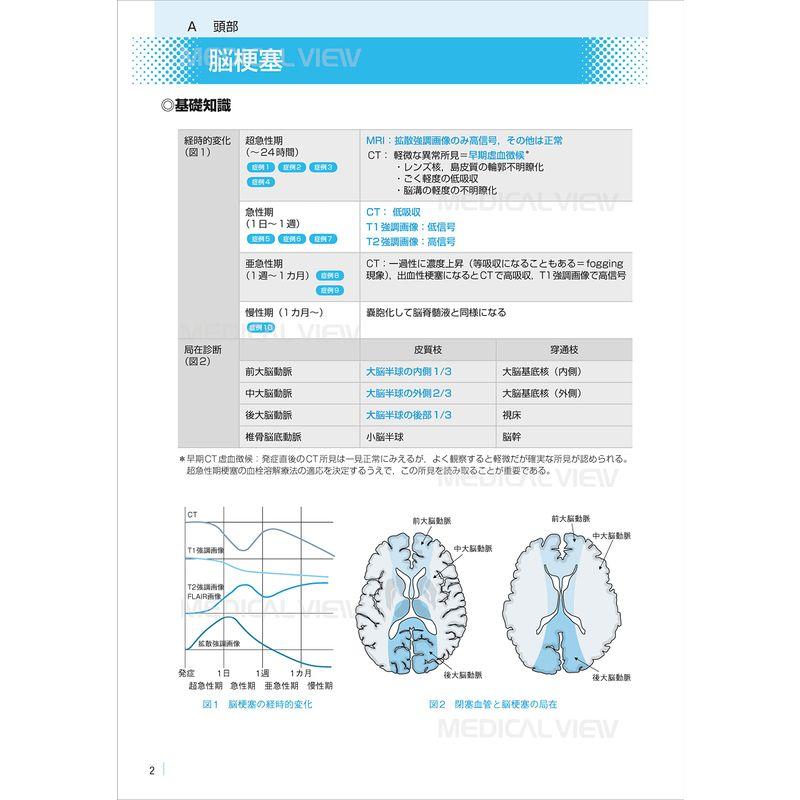 医学生のための画像診断マニュアル 国試問題攻略ガイド