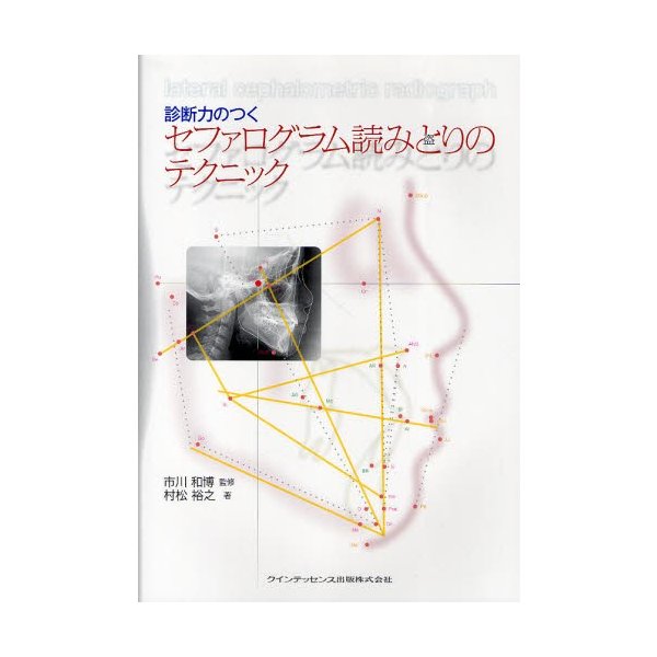 診断力のつくセファログラム読みとりのテクニック