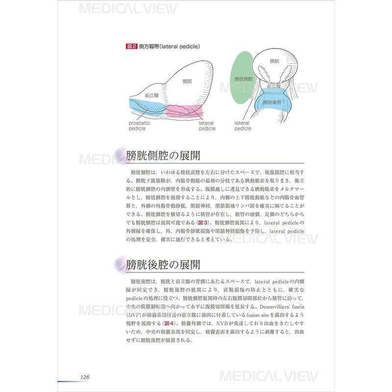 膀胱癌診療最前線