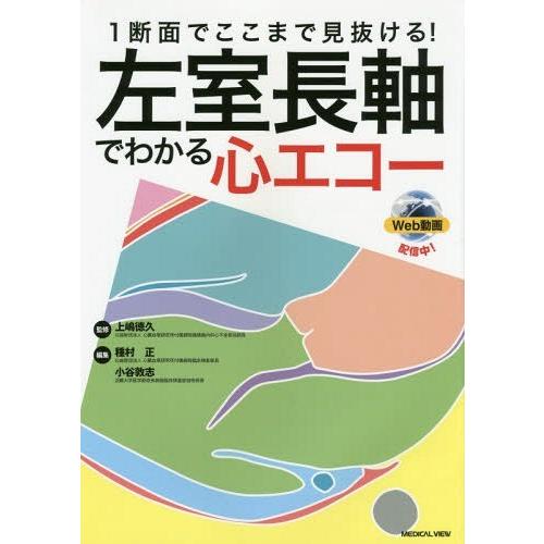 1断面でここまで見抜ける 左室長軸でわかる心エコー