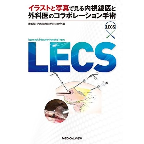 LECS?イラストと写真で見る内視鏡医と外科医のコラボレーション手術