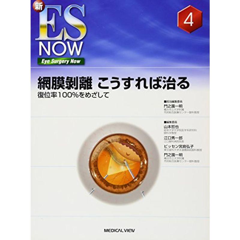 網膜剥離 こうすれば治る−復位率100%をめざして (新ES Now 4)