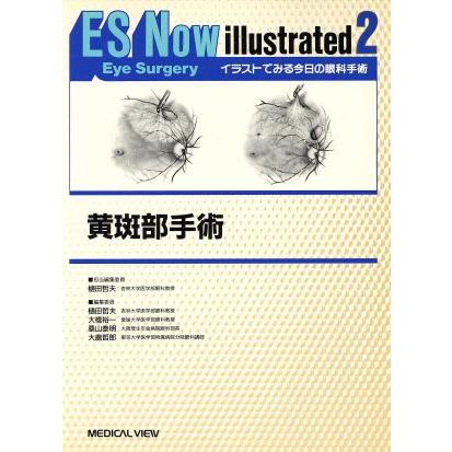 黄斑部手術 イラストでみる今日の眼科手術２／樋田哲夫(編者),大橋裕一(編者),桑山泰明(編者),大鹿哲郎(編者)