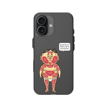 iPhone 17 Clear (相機按鈕) 酷墨灰 - 保羅先生 Mr.Paul - 圖解人體部位