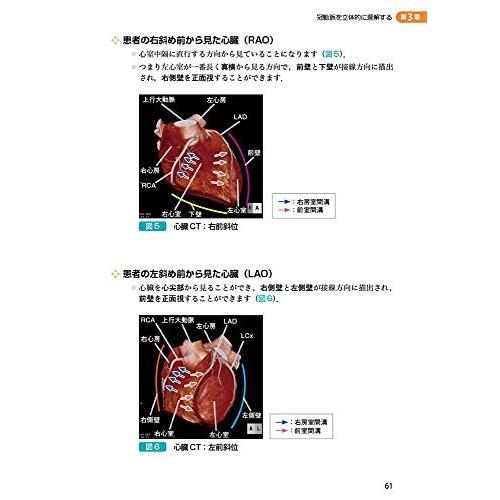 そうだったのか!  絶対読めるCAG?シェーマでわかる冠動脈造影の読み方