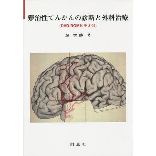 難治性てんかんの診断と外科治療 堀智勝