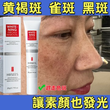 高雄出貨【熱銷】斑 老人斑 雀斑 斑點 黃褐斑 曬斑 黑色素 黑斑 毛孔 發黃 美容養顏 遠離黃氣 素顏女神 升級2.0