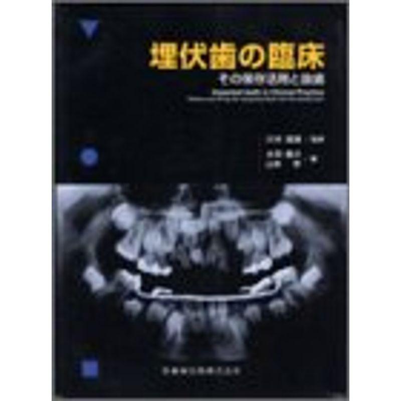 埋伏歯の臨床?その保存活用と抜歯