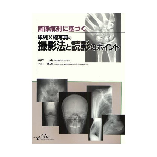 画像解剖に基づく単純X線写真の撮影法と読影のポイント