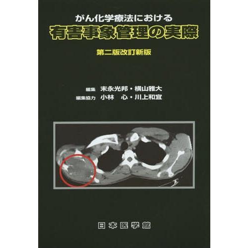 がん化学療法における有害事象管理の実際