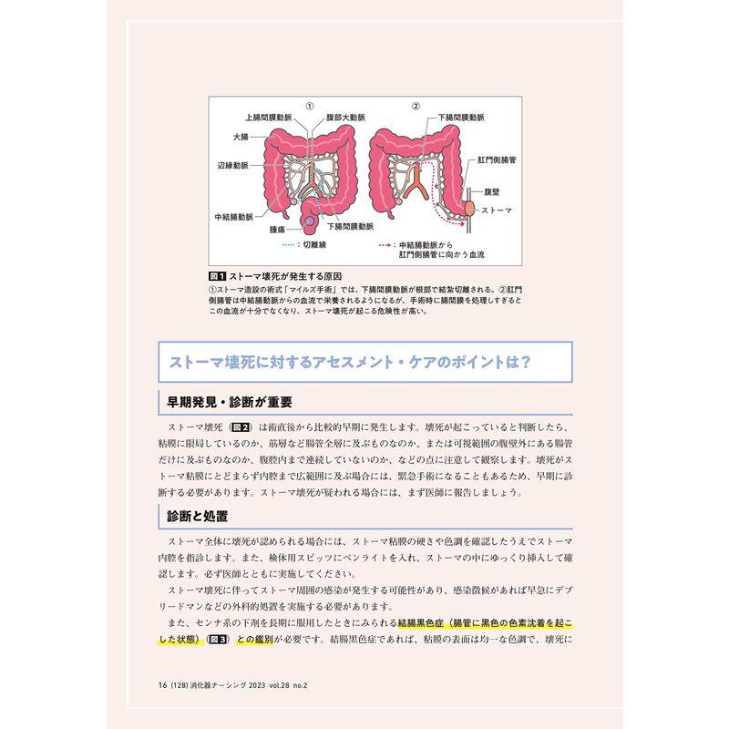 消化器ナーシング 2023年2月号 ストーマ合併症のアセスメント＆ケア講座（第28巻2号）