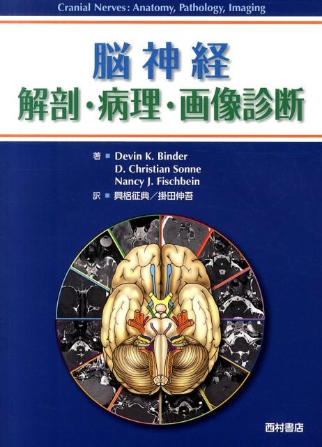 デヴィン K.ビンダー 脳神経解剖・病理・画像診断[9784890134441]