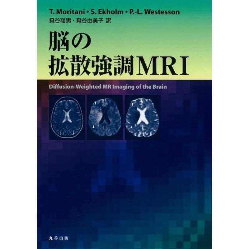 脳の拡散強調MRI