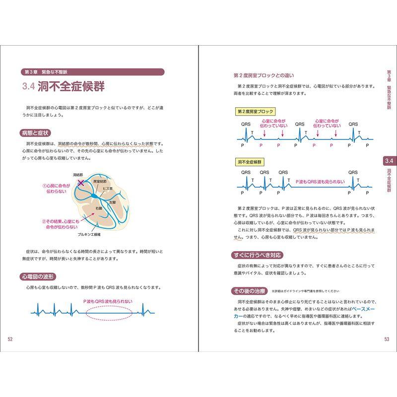 レジデントのための これだけ心電図