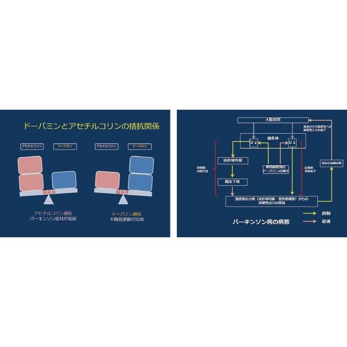 パーキンソン病の理学療法 〜パーキンソン病の基本と歩行障害への対応〜[理学療法 ME294-S 全2巻・分売不可]