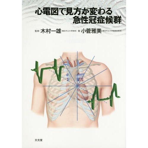 心電図で見方が変わる急性冠症候群