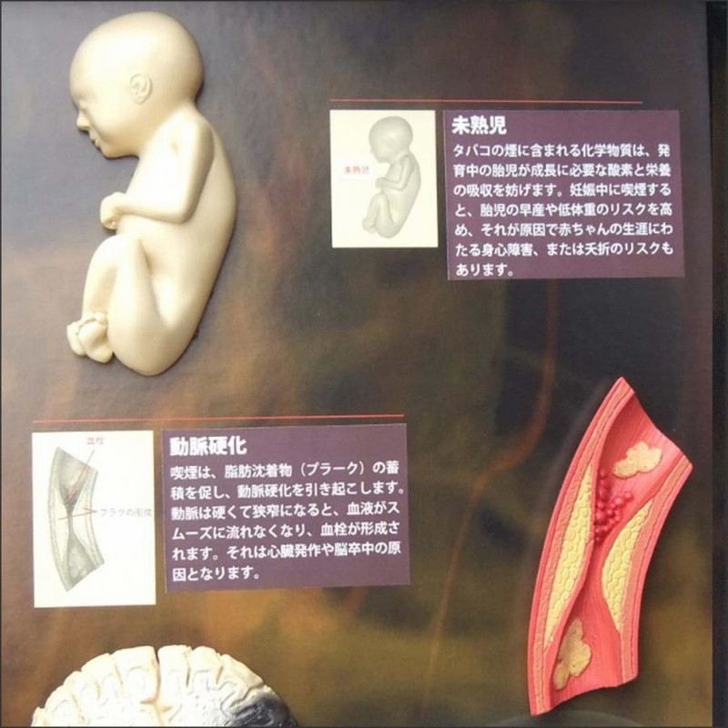 展示用模型ディスプレイ 喫煙の害 リアルな教材で見る禁煙教育