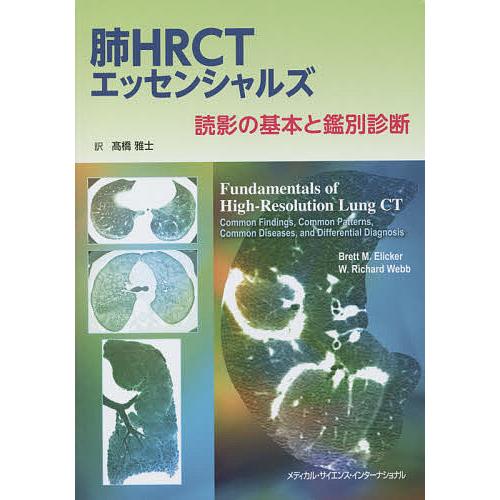 肺HRCTエッセンシャルズ 読影の基本と鑑別診断