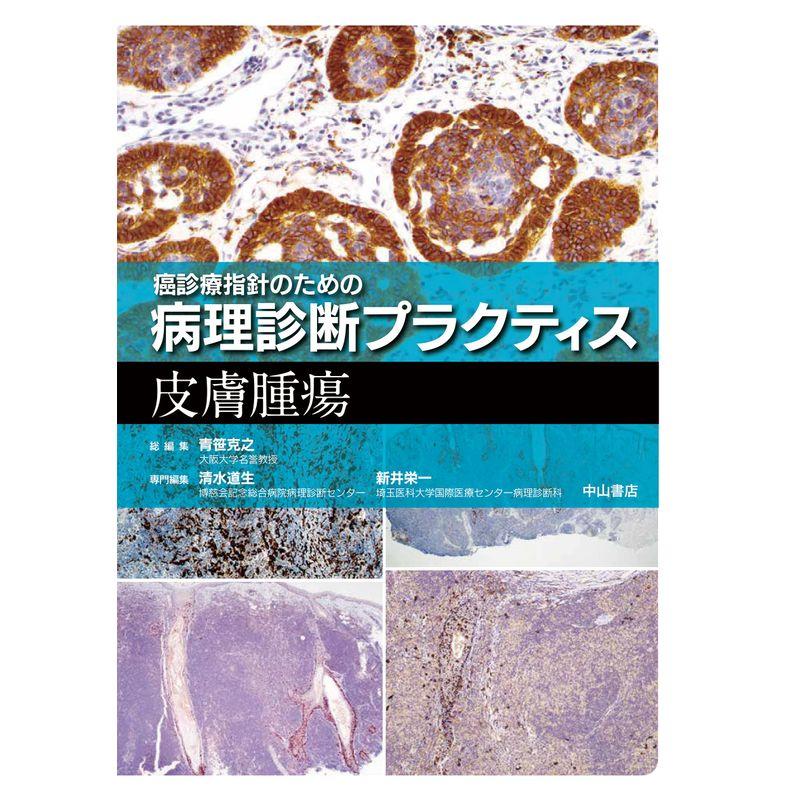 皮膚腫瘍 (癌診療指針のための病理診断プラクティス)