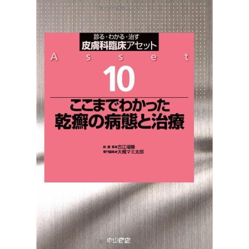 ここまでわかった 乾癬の病態と治療 (皮膚科臨床アセット)