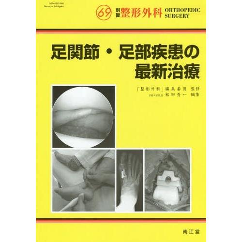 足関節・足部疾患の最新治療