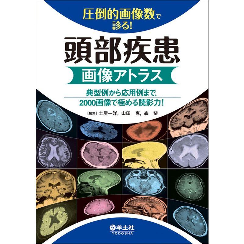 圧倒的画像数で診る 頭部疾患画像アトラス~典型例から応用例まで,2000画像で極める読影力