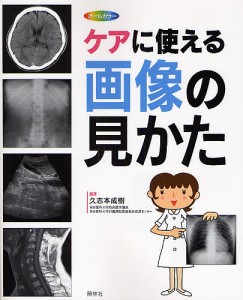 ケアに使える画像の見かた X線写真・CT画像・エコー像・MRI