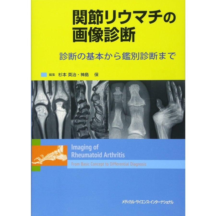 関節リウマチの画像診断 診断の基本から鑑別診断まで