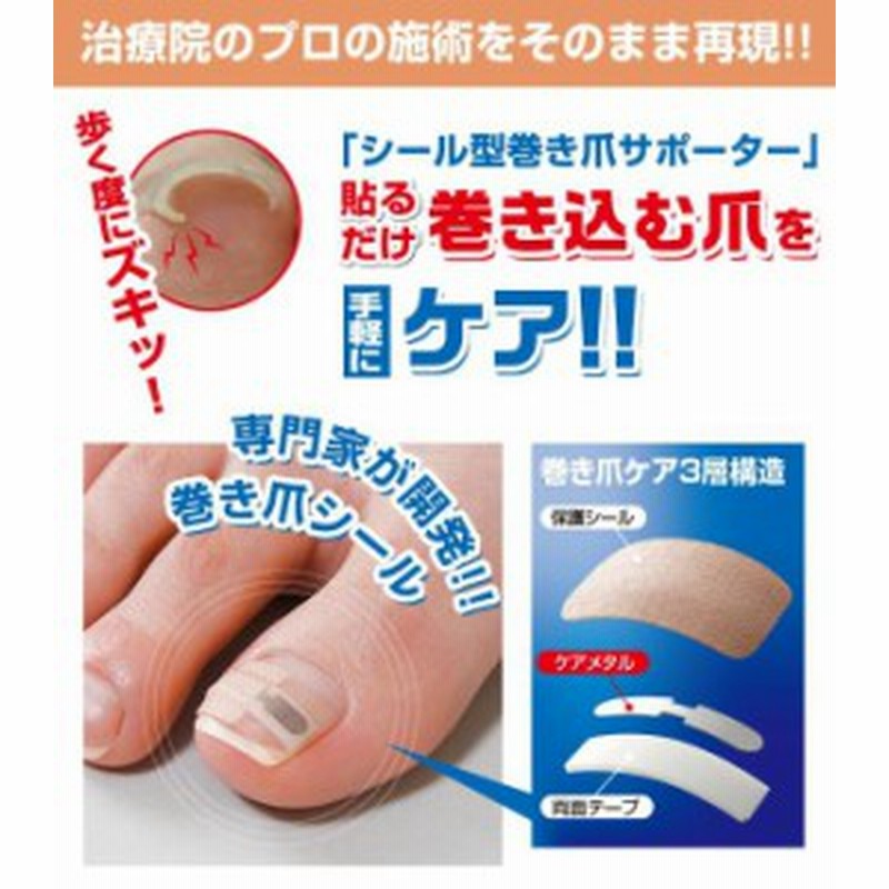 ネコポス発送 送料250円 テーピング 巻き爪シール 1ヶ月ケア 巻きづめ ワイヤー 補正 通販 Lineポイント最大1 0 Get Lineショッピング