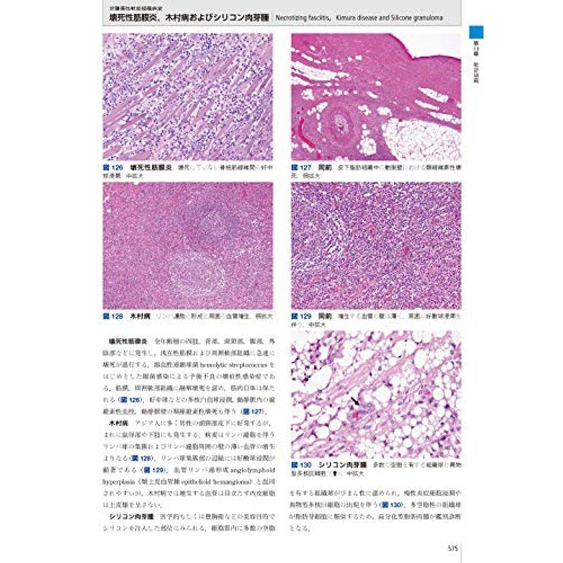 カラーアトラス 病理組織の見方と鑑別診断 第6版